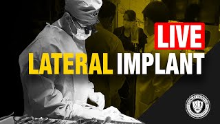 Lateral Implant Placement amp Temporization [upl. by Roosnam215]