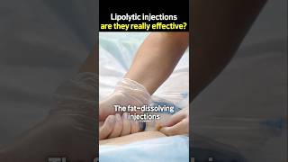 Lipolytic injections are they really effective [upl. by Angy]