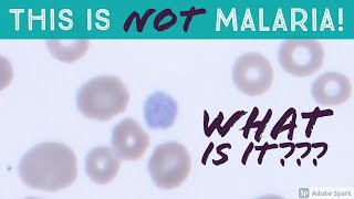 This is NOT Malaria What is it An Important Mimic of Plasmodium vivax Gametocyte on Blood Smear [upl. by Paley]