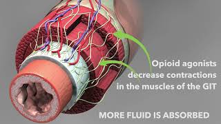 Opioid antidiarrheal medications Loperamide and diphenoxylate [upl. by Ellebyam]