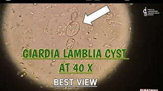 Giardia Lamblia cyst view at 40 XBest microscopic view of giardia cystgiardia parasite in stool [upl. by August]