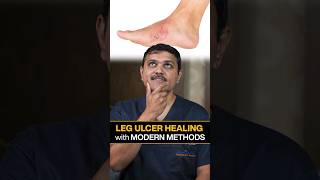 Revealed Innovative Ways to Heal LEG ULCERS Quickly legulcer shortsvideo vascularsurgeon [upl. by Laurita545]