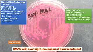 Sorbitol Macconkey Agar for screening E coli O157H7 [upl. by Sairu73]