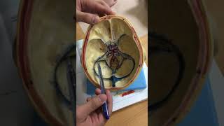 dural venous sinus model explanation [upl. by Nolrah444]