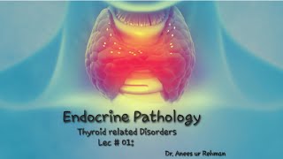 Endocrine Pathology  Hashimotos Thyroiditis lec 01 Pathology robbinsbasicpathology concept [upl. by Eelsha466]