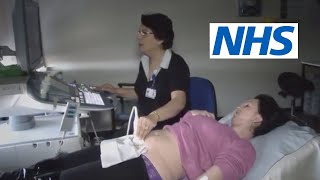 What happens at a scan and what will they tell me  NHS [upl. by Adilem]