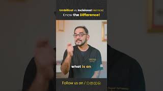 What is an Umbilical and Incisional hernia  Dr Deepak Subramanian [upl. by Kerek]