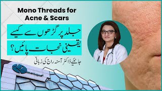 Mono Threads For Acne Scars  Dr Amnah Raj  Cosmetique [upl. by Adnale]