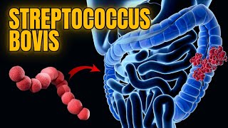 All About Streptococcus bovis Causes Pathogenesis Symptoms amp Treatment  Microbiology 101 Lec [upl. by Eniaral]