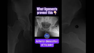 What ligaments prevent the anterior dislocation of hip joint shorts drsamsanatomyclasses [upl. by Gilberte477]