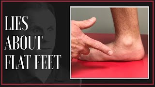 The Big Lie About Flat Feet amp Custom Arch Support Updated [upl. by Melantha613]