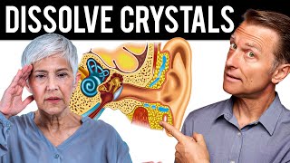 How to Dissolve Crystals in the Inner Ear and Get Rid of Vertigo [upl. by Zinah]