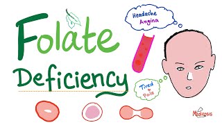 Folate deficiency  Megaloblastic Anemia  Macrocytic  Hematology Series [upl. by Lletnwahs]