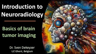 Radiology of Brain Tumors the basics [upl. by Elder]