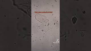 what urine sediment is this urine urinalysis microscope laboratory bacteria urinesediment [upl. by Hadias]