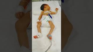 NICU Convulsion of a neonate abnormal movement babyhealth NewbornCare [upl. by Hylton629]