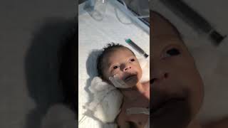 Chestryped for newborn baby😌 sumitnicunursingstm youtubeshorts nursing newbornbaby chestworkout [upl. by Yseulte]