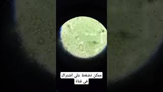 Biologie Balantidium coli biology علمالأحياء science microscope microscopy parasite shorts [upl. by Stock]