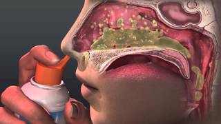 Can Saline Irrigation Help Nasal Allergies Animated Guide to Saline Nasal Irrigation [upl. by Eenel153]