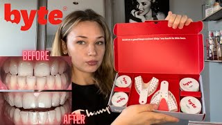 Byte Aligners Journey  How Much Did They Cost Are They Worth It [upl. by Rann]