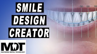 ExoCad Smile Design tutorial for a Wax Up or Crown Design in Plovdiv 24 [upl. by Noroj]