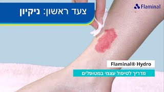 Flaminal® Hydro  מדריך לטיפול עצמי במטופלים [upl. by Starla478]