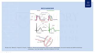 Early Repolarization Syndrome [upl. by Auof]