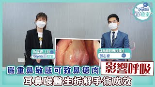 【TOPick診症室】廚師失嗅覺揭患鼻瘜肉 醫生指嚴重鼻敏感屬高危因素 [upl. by Pattin]