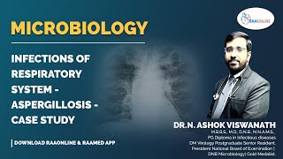 Microbiology  Aspergillosis  Case study  Raaonline [upl. by Eillib]