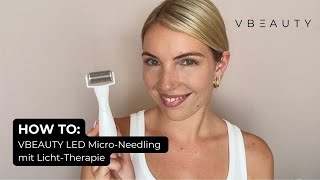 HOW TO VBEAUTY LED MicroNeedling Dermaroller mit integrierter Lichttherapie [upl. by Ettenowtna]