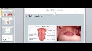 Thyroid Disorders  Hypo and Hyperthyroidism  Surgery Lecture [upl. by Annayhs]