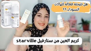 كريم ستارفيل للعين starville eye contour gel للهالات السوداء والإنتفاخات وهل فعال في علاج الهالات⁉️ [upl. by Arlan649]