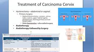 Gynecology 305 Prevent Treat Carcinoma Cervix Cervical Cancer HPV vaccine Cervarix Gardasil LLETZ [upl. by Radman]