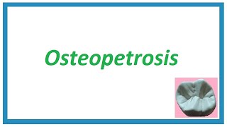 OsteopetrosisMarble bone disease  Important Notes  Diseases of Bone and Joint 1  Oral Pathology [upl. by Dex]