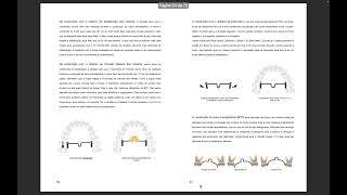 Manual básico de ortodontia e mecânica em typodomt [upl. by Nasus]