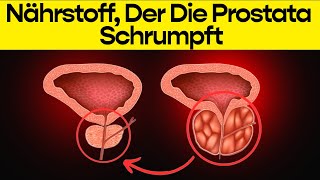 Sie Werden Nicht An Den Nährstoff Glauben Der Die Prostata Auf Natürliche Weise Schrumpft [upl. by Hardej]