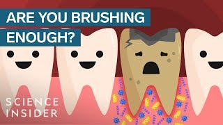 Heres What Happens If You Stopped Brushing Your Teeth [upl. by Tterej]