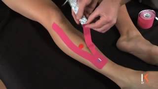 KT Tape  Kinesiology Taping Instructions for Shin Splints  Anterior [upl. by Lunsford]