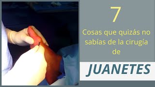 7 COSAS QUE QUIZÁS NO SABÍAS DE LA CIRUGÍA DE JUANETES [upl. by Hannavahs]