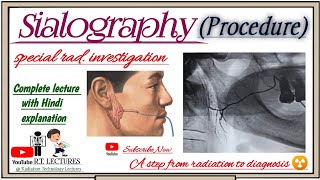 Sialography Procedure Complete Lecture Sialography radiology complete video Lecture in hindi [upl. by Keldah]