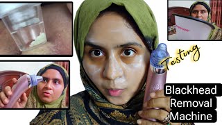 Blackheads Removal Machine Testing Vacuum Blackhead Remover Electric Face Pore Cleanersunialife [upl. by Aimik]