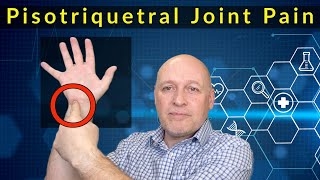 Pisotriquetral Wrist Joint Pain  Advice Self Help and Treatment [upl. by Winne]