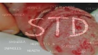 STD Sexually Transmitted Diseases NCERT Tricks [upl. by Iv863]