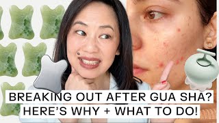 TCM Practitioner Explains Gua Sha Breakouts And How To Prevent Them [upl. by Htnnek]