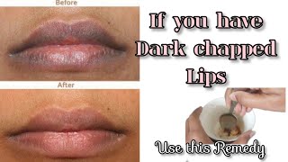 Dark Lips ⁉️ Best remedy for chapped lips👄 100 Results [upl. by Swee86]