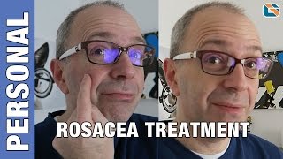 Rosacea Mirvaso Gel Cream Treatment Test  Geek Vlog 376 Rosacea [upl. by Eceirahs721]