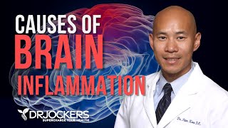 Causes Of Brain Inflammation Dr David Jockers [upl. by Lichter31]