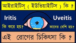 anterioruveitis iritis Iritis or Anterior uveitis symptoms signs and treatment discussed [upl. by Nonnaer396]