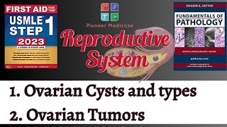 USMLE step1Ovarian cysts and Ovarian Tumors Part 1 from First AidReproductive PathologyUrduHindi [upl. by Icnarf]