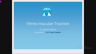 Vitreo Macular Traction by Dr Sushant Madaan 07 Nov 2019 [upl. by Pappano38]